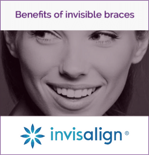 Invisalign