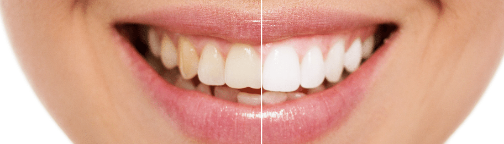 Stuart Steven Dental Practice - Smile Makeover